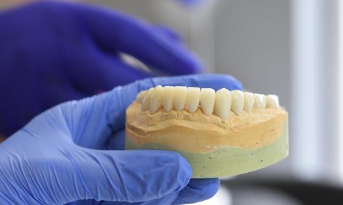 dental implant post op instructions pdf