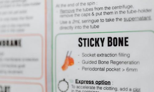 post op instructions for extractions in spanish